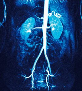 What is an angiography or arteriography? - LabUncle
